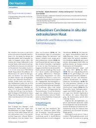 Mně se na něm líbí, že působí preventivně. Pdf Sebazioses Carcinoma In Situ Der Extraokularen Hautsebaceous Carcinoma In Situ In Extraocular Skin Fallbericht Und Diskussion Eines Neuen Entitatskonzeptscase Report And Discussion Of The New Entity