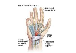 I have pain and swelling on the joint at the base of my pinky. Tingling In Your Fingers Is It Carpal Tunnel Or Something Else Sheltering Arms