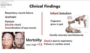 Intensive doctor and nurse care is necessary while the paralysis heals. Pashto Medicine Clostridia Botulinum Pashto Facebook