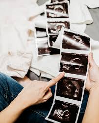 Hallo merle, ob eine schwangerschaft möglich ist, hängt von deinem eisprung ab. Schwangerschaft Erkennen Diese 5 Symptome Kennt Kaum Jemand Active Beauty