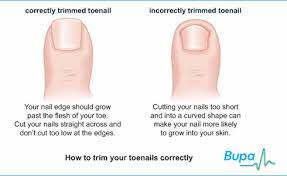 Hangnails What Are They And How To Prevent Them Palm Desert Palm Springs Contour Dermatology Ingrown Toe Nail Nail Remedies Toe Nails