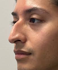 Gallery of Procedures