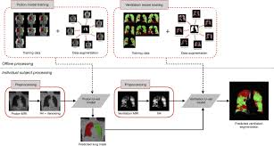 8 tab divider template staples template 1 : Convolutional Neural Networks With Template Based Data Augmentation For Functional Lung Image Quantification Academic Radiology
