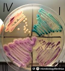 Candida Albicans Candida Glabrata Candida Krusei And Candida Parapsilosis On Chromagar Image Source Microbiologyl Microbiology Microbiology Lab Petri Dish
