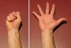 The information posted on this page on finger dislocation is for learning purposes only. Dislocated Finger Finger Dislocation Physioadvisor