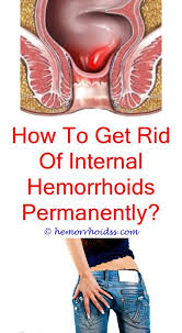 Pin On Hemorrhoids Remedie