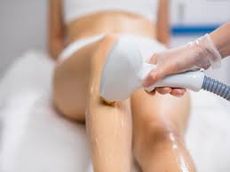 Laser Hair Removal | Laser It Salon & Medical Spa