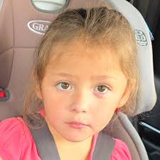 Fundraiser by Tabitha Morales-santillan : Help Athena Remove Painful Eye  Tumor