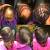 Severe Scalp Damage From Weave