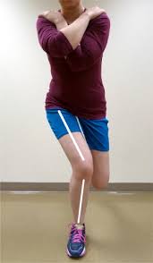 Dynamic Knee Valgus Kinematics And Their Relationship To Pain In Women With Patellofemoral Pain Compared To Women With Chronic Hip Joint Pain Sciencedirect