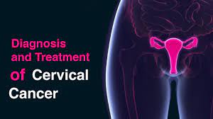 Treatments include surgery, chemotherapy, and radiation therapy. Cervical Cancer Diagnosis And Assessment Gtak Health