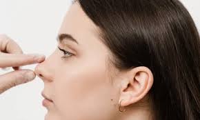 Rhinoplasty Turkey, Rhinoplasty Affordable Cost and Results | Vanity