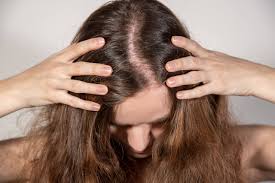 Even applying eyeliner/pencil too hard for a long anything that affects the hair also affects eyebrows to some extent. What Causes Hair Loss In Women And How To Treat It Elithair