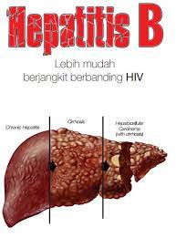 Hepatitis b dapat menyebar dengan mudah, biasanya hepatitis b menyebar melalui: Tonik Hati Rawatan Penyakit Hati Hepatitis Kenali Hepatitis B