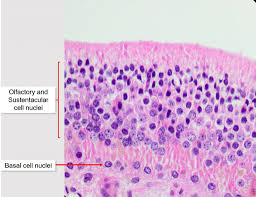 Medial wall of nasal cavi… Air Conduction Nasal Cavity Paranasal Sinuses And Vomeronasal Organ Veterinary Histology