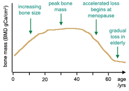 Bone Mass Density Causes Symptoms Treatment Bone Mass Density