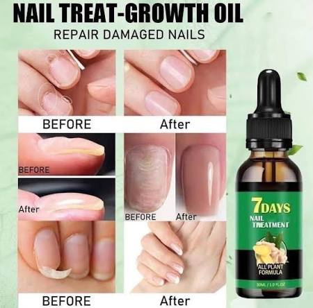 💅 7 Days Nails – Endurecedor de Uñas (Pack x2) 💅 Fortalece, repara y acelera el crecimiento de tus uñas en solo días. Su fórmula avanzada con proteínas y calcio ayuda a