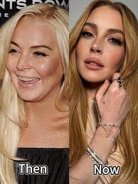 Lindsay Lohan Now Real