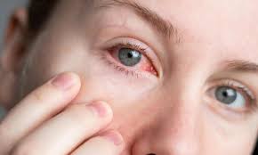 Image result for Eye Pain without Redness