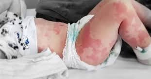 — los nuestros son así — dice juana. A Pesar De Que Aumentan Casos En Chile Los Efectos Del Covid 19 En Ninos Aun Son Un Misterio Interferencia