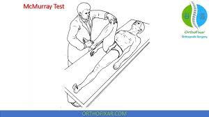 Image result for McMurray Test