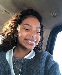 Light skin boys with braces. Braces Curly Hair Braces Baddies Pretty Light Skin Girl Instagram Novocom Top