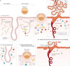 Image result for Recurrent Miscarriage