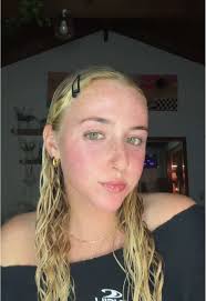 Blonde Freckled Famous Girl