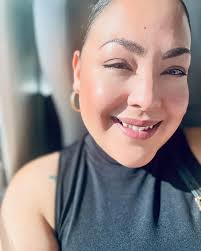 Recommendations for reconstructive plastic surgeons from personal experience