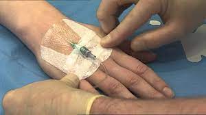 Learn more about 3m™ tegaderm™ foam adhesive dressing application and removal. 3m Tegaderm I V Advanced Securement Dressing 1681 Application Horizontal Strips Youtube