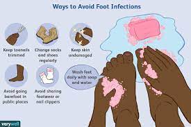 We did not find results for: Common Fungal And Bacterial Infections Of The Foot
