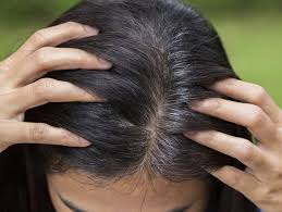 Some go gray or even completely white relatively early in life; Grey Hair At 30 Home Remedies To Reverse The Problem Home Remedy To Get Rid Of Grey Hair