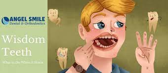 Wisdom tooth pain, how to manage from home until you can see a dentist. What To Do When Your Wisdom Teeth Hurt Angel Smile