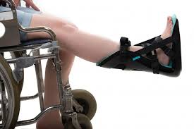 Image result for Posterior Night Splint