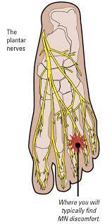 Cycling Foot Pain Archives Bikefit