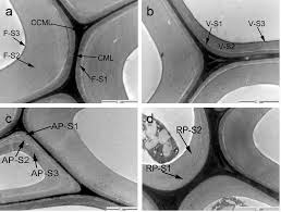 It is developed from the vascular cambium (a lateral meristem). Ultrastructure And Topochemistry Of Plant Cell Wall By Transmission Electron Microscopy Intechopen