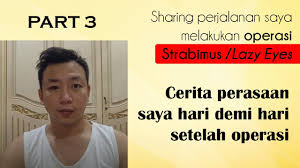 Maybe you would like to learn more about one of these? Part 1 Informasi Biaya Dan Persiapan Untuk Operasi Strabismus Juling Atau Lazy Eyes Mata Malas Youtube
