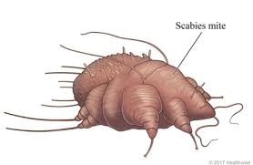 Image result for what does scabie look like