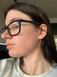 Any recommendations for skin care products?