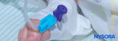 Image result for Difficult Intravenous Access in Children