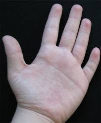 Image result for Hand Exam
