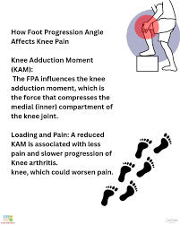 Image result for Foot Progression Angle