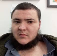 Can epilepsy sometimes cause anger feeling annoyed or to lash out at someone