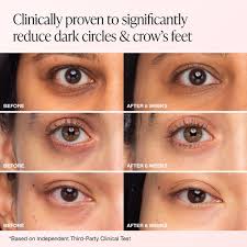 Image result for Eye Acidity Test