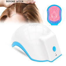 Read on to learn more about this tre. Lllt Hair Loss Therapy Laser Cap 680nm 850nm 150 Diodes Laser Hair Growth Helmet Anti Hair Loss Hair Loss Alopecia Hair Loss Regrowth