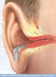Pin On Otolaryngology