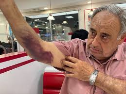 Killing of 'Shakira' Enrages Horse Owners in Sylmar