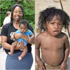 Skin Tone And Hair Texture Babycenter