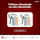 Prótese cimentada ou não cimentada, qual a melhor para se ...