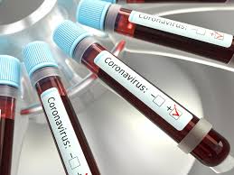 Der letzte spieltag in der gruppe b steht an. Coronavirus In Koln Alle Aktuellen Infos Im Live Ticker Stand 29 06 2021